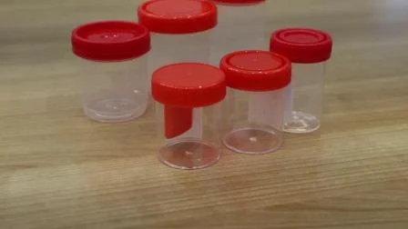 Sputum Containers (Specimen Container, Urine Container and others)